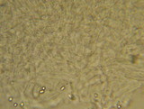 Melanoleuca lewisii image
