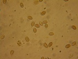 Galerina tibiicystis image