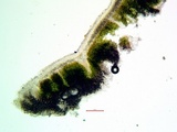 Acarospora obnubila image