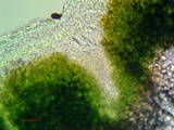 Acarospora obnubila image