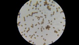Agaricus andrewii image