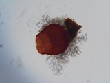 Sphaerostilbella berkeleyana image