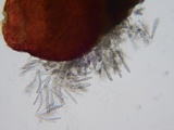 Sphaerostilbella berkeleyana image