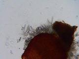 Sphaerostilbella berkeleyana image