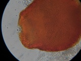 Sphaerostilbella berkeleyana image