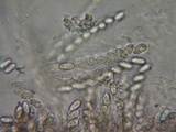 Sphaerostilbella berkeleyana image