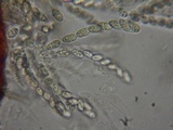 Sphaerostilbella berkeleyana image