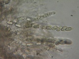 Sphaerostilbella berkeleyana image