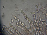 Sphaerostilbella berkeleyana image