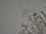 Sphaerostilbella berkeleyana image