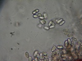 Sphaerostilbella berkeleyana image