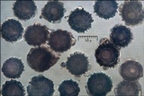 Scleroderma areolatum image