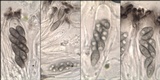 Rinodina oleae image