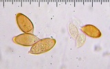 Cortinarius calyptratus image