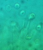 Trechispora farinacea image
