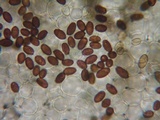 Coprinopsis cinerea image
