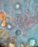 Trechispora farinacea image