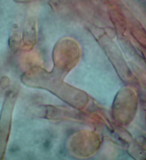 Trechispora farinacea image