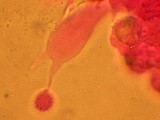 Laccaria fraterna image