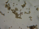 Lycoperdon pratense image