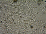 Lycoperdon pratense image