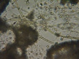 Lycoperdon pratense image