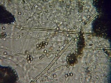 Lycoperdon pratense image