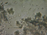 Melanoleuca exscissa var. exscissa image