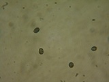 Melanoleuca exscissa var. exscissa image