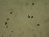 Melanoleuca exscissa var. exscissa image