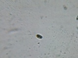 Phlebia acerina image