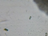 Phlebia acerina image