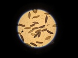 Xylaria cornu-damae image