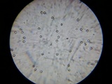 Pluteus longistriatus image