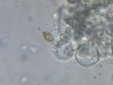 Echinoderma asperum image