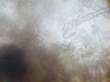 Echinoderma asperum image