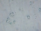 Echinoderma asperum image