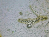 Hymenoscyphus calyculus image