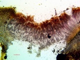 Peltula patellata image