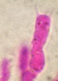 Tubulicrinis chaetophorus image