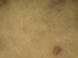 Leccinellum pseudoscabrum image