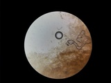 Phlebiella christiansenii image