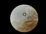 Phlebiella christiansenii image
