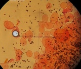 Coprinellus saccharinus image