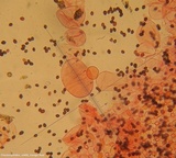Coprinellus saccharinus image