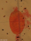 Coprinellus saccharinus image