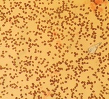 Coprinellus saccharinus image