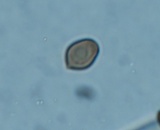 Coprinellus saccharinus image