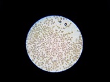 Scleroderma polyrhizum image