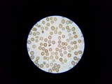 Scleroderma polyrhizum image
